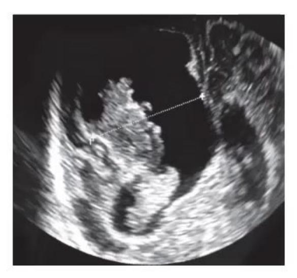 images/MNJ-P-OSCE 30. Gastroenterology_page_15_Picture_16.jpeg