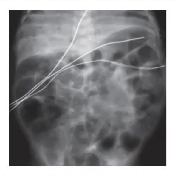 images/MNJ-P-OSCE 30. Gastroenterology_page_17_Picture_5.jpeg