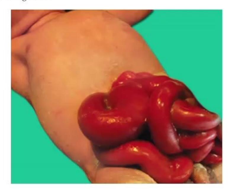 images/MNJ-P-OSCE 30. Gastroenterology_page_18_Picture_13.jpeg