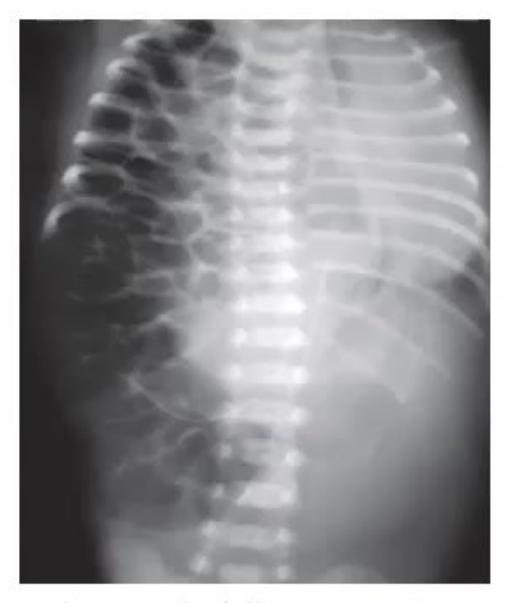 images/MNJ-P-OSCE 30. Gastroenterology_page_18_Picture_7.jpeg