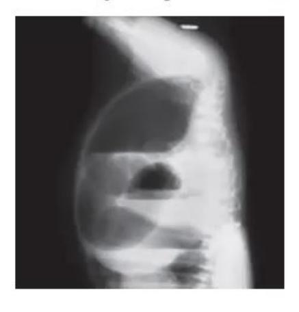 images/MNJ-P-OSCE 30. Gastroenterology_page_20_Picture_32.jpeg