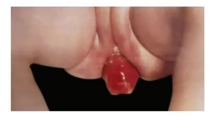 images/MNJ-P-OSCE 30. Gastroenterology_page_21_Picture_22.jpeg