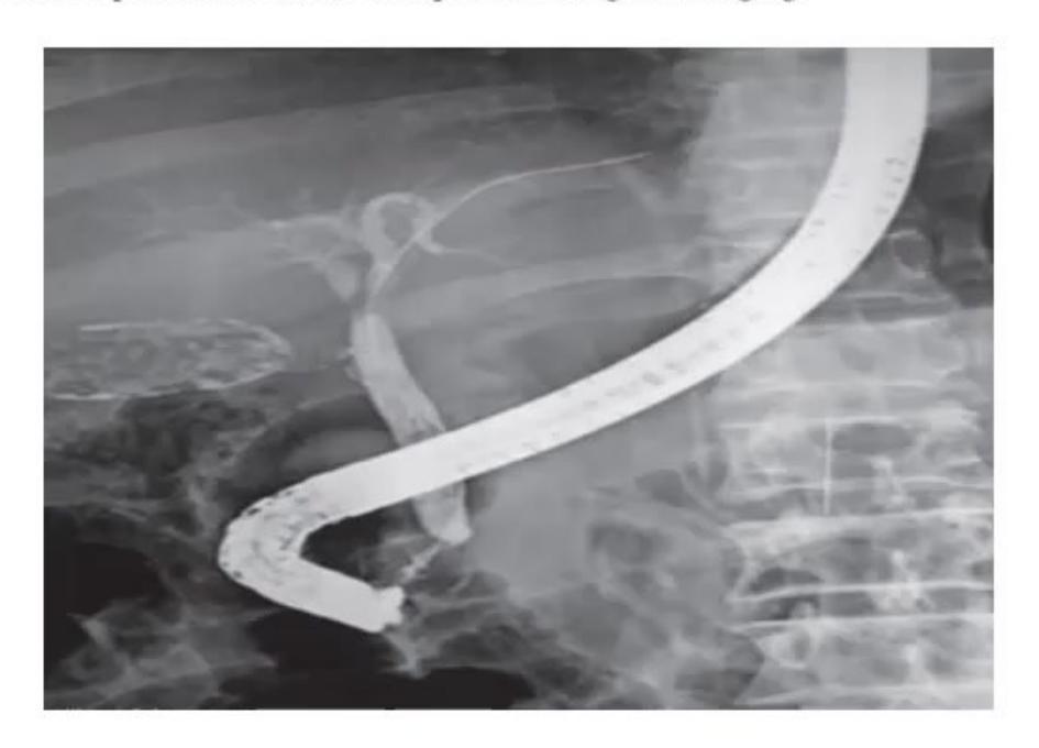 images/MNJ-P-OSCE 30. Gastroenterology_page_8_Picture_7.jpeg
