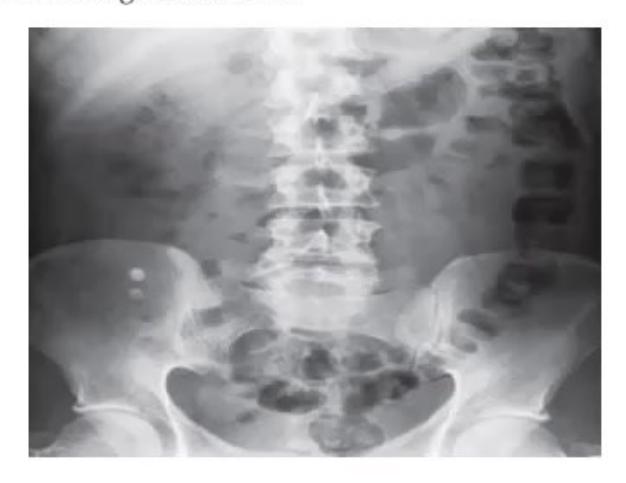 images/MNJ-P-OSCE 30. Gastroenterology_page_9_Picture_14.jpeg