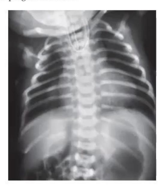 images/MNJ-P-OSCE 30. Gastroenterology_page_9_Picture_7.jpeg