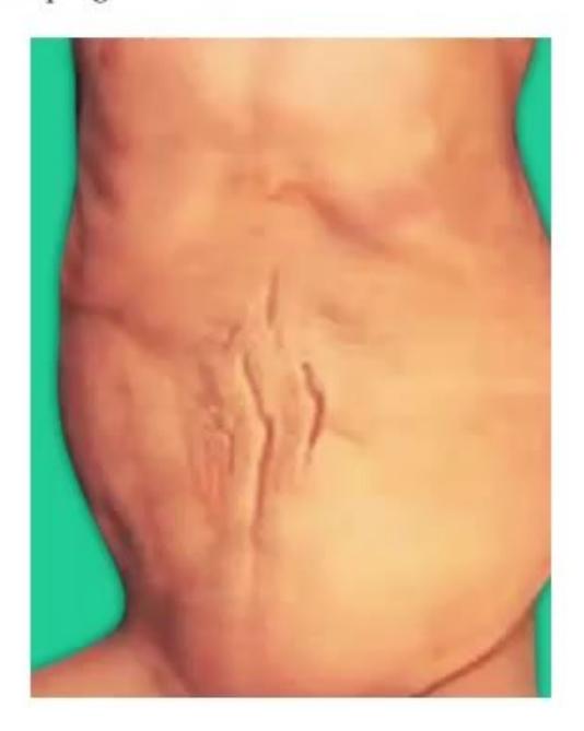 images/MNJ-P-OSCE 31. Nephrology_page_1_Picture_5.jpeg