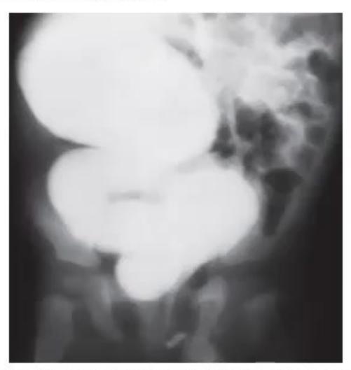 images/MNJ-P-OSCE 31. Nephrology_page_2_Picture_16.jpeg