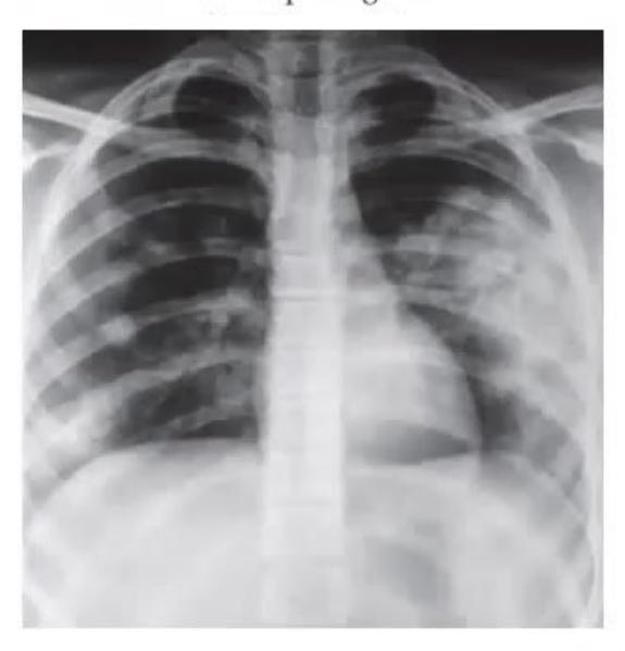 images/MNJ-P-OSCE 31. Nephrology_page_3_Picture_7.jpeg