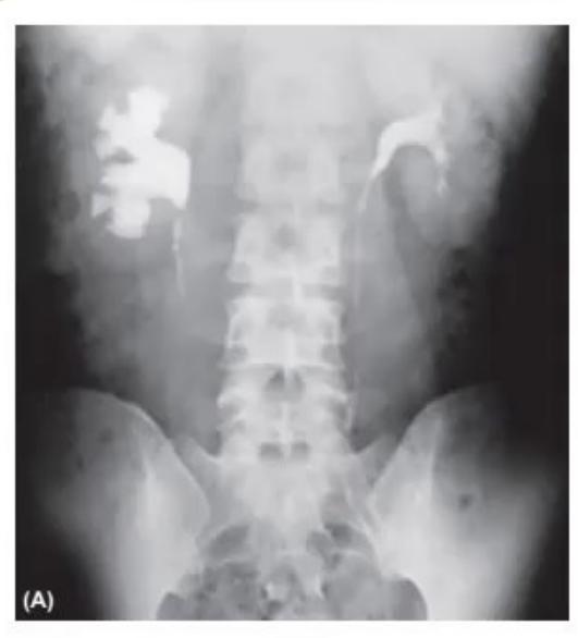 images/MNJ-P-OSCE 31. Nephrology_page_4_Picture_1.jpeg