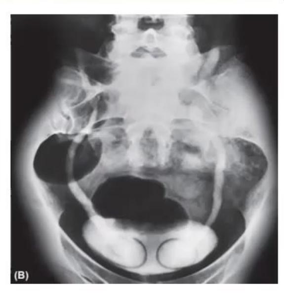 images/MNJ-P-OSCE 31. Nephrology_page_4_Picture_2.jpeg