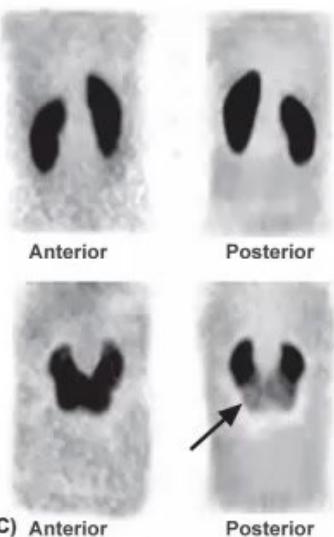 images/MNJ-P-OSCE 31. Nephrology_page_4_Picture_3.jpeg