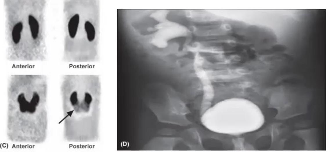 images/MNJ-P-OSCE 31. Nephrology_page_4_Picture_4.jpeg