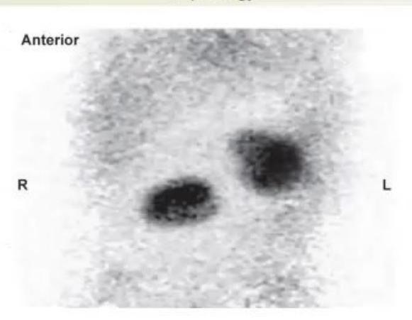images/MNJ-P-OSCE 31. Nephrology_page_6_Picture_1.jpeg