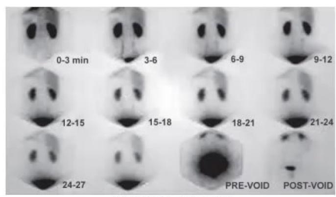 images/MNJ-P-OSCE 31. Nephrology_page_9_Figure_26.jpeg