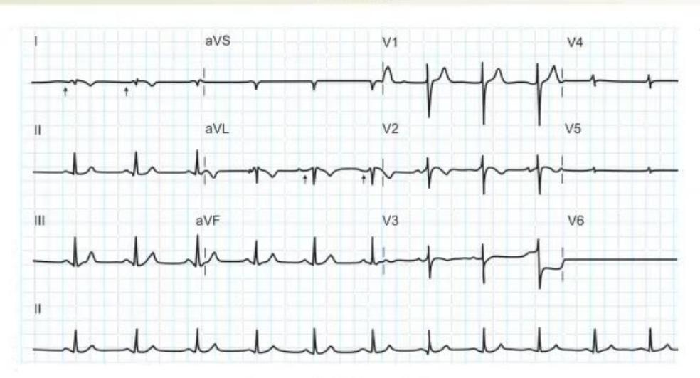 images/MNJ-P-OSCE 33. CVS_page_4_Figure_1.jpeg