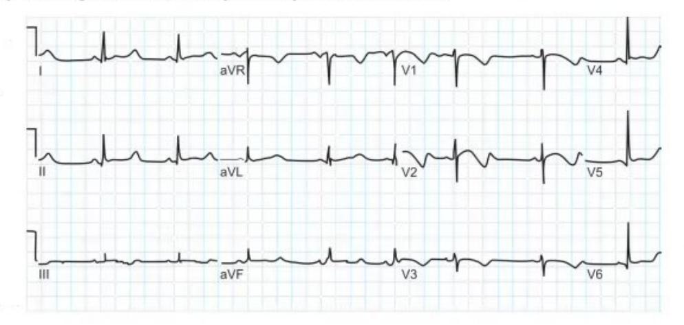 images/MNJ-P-OSCE 33. CVS_page_4_Figure_17.jpeg