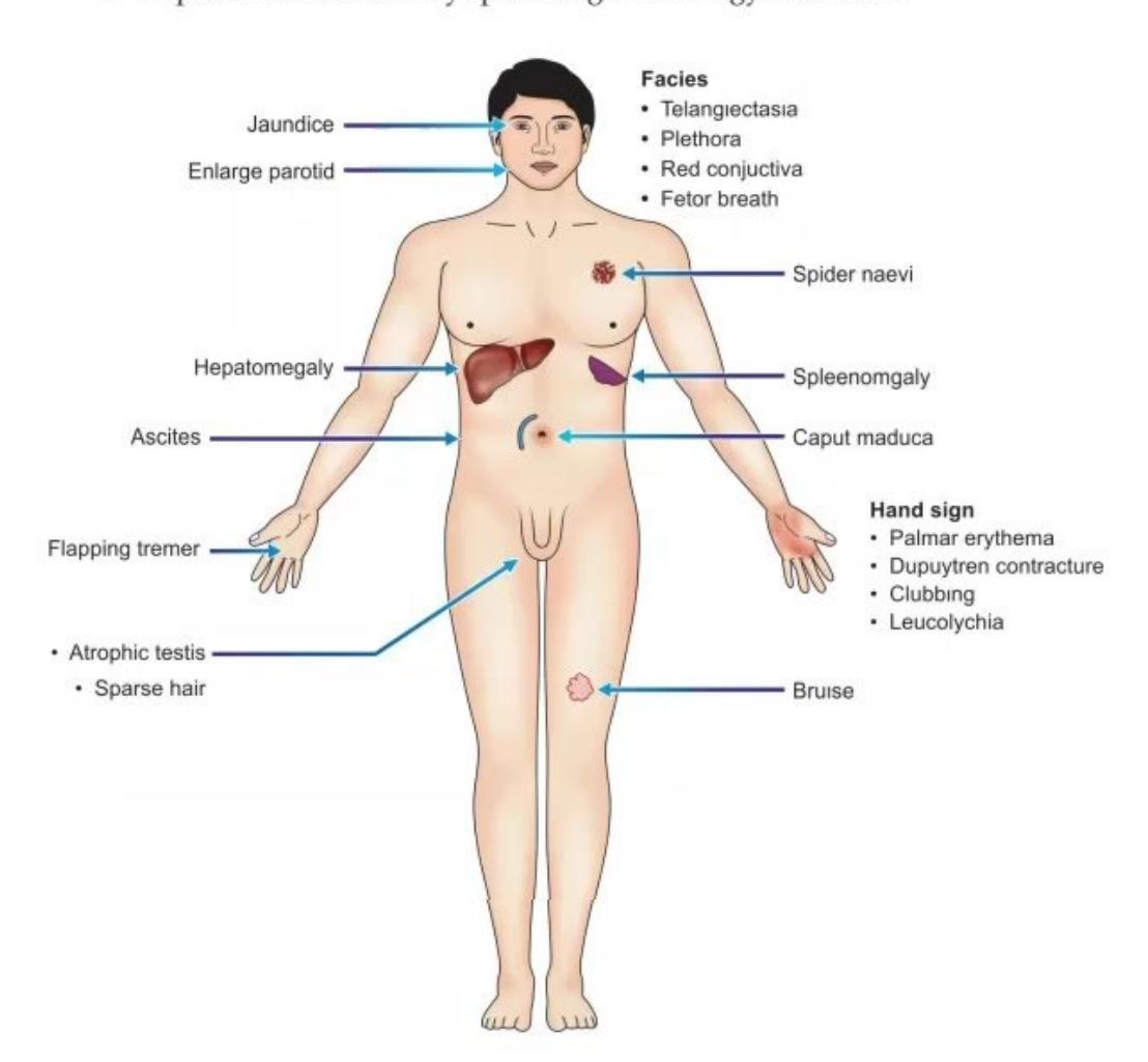 images/MNJ-P-OSCE 36. Focused Clinical Examination_page_11_Figure_16.jpeg