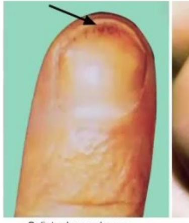 images/MNJ-P-OSCE 36. Focused Clinical Examination_page_8_Picture_29.jpeg