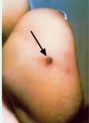 images/MNJ-P-OSCE 36. Focused Clinical Examination_page_8_Picture_31.jpeg