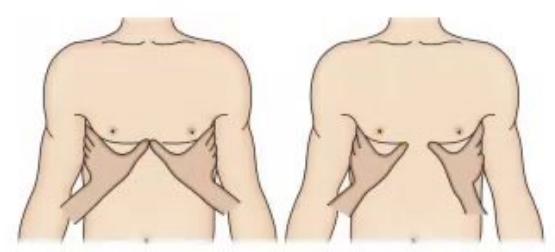 images/MNJ-P-OSCE 36. Focused Clinical Examination_page_9_Picture_32.jpeg