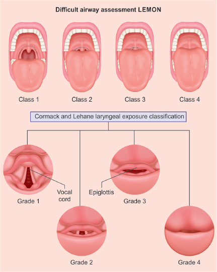 images/image_rsrc1ZCX.jpg