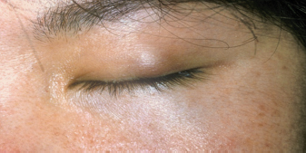 images/image_rsrc1ZMM.jpg
