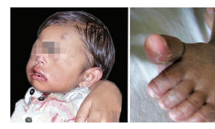 images/VVK-P-Osce 1. Connective Tissue_page_1_Picture_8.jpeg