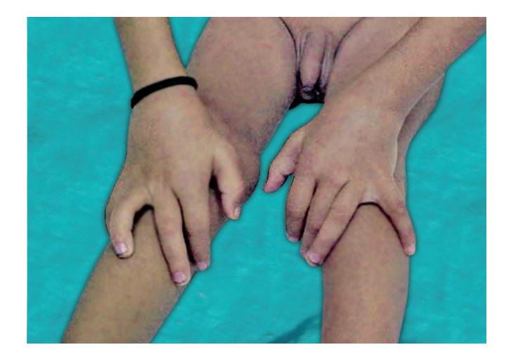images/VVK-P-Osce 1. Connective Tissue_page_2_Picture_11.jpeg