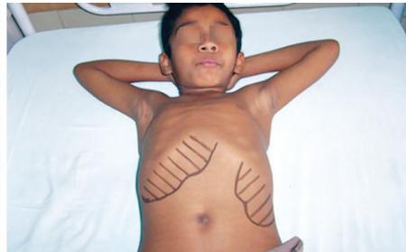 images/VVK-P-Osce 1. Connective Tissue_page_5_Picture_4.jpeg