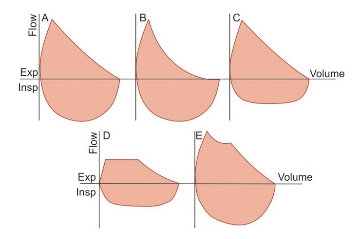 images/VVK-P-Osce 12. Respiratory System_page_4_Figure_3.jpeg