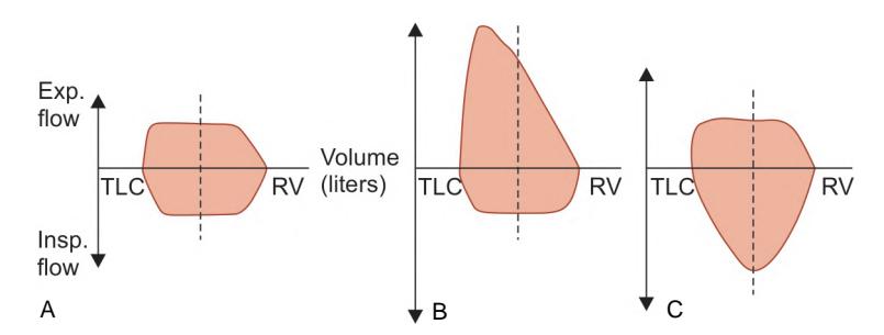 images/VVK-P-Osce 12. Respiratory System_page_4_Figure_5.jpeg