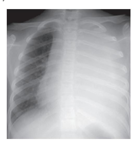 images/VVK-P-Osce 12. Respiratory System_page_8_Picture_13.jpeg