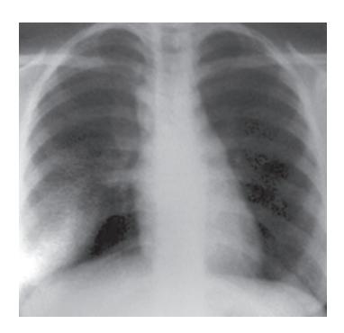 images/VVK-P-Osce 12. Respiratory System_page_9_Picture_5.jpeg