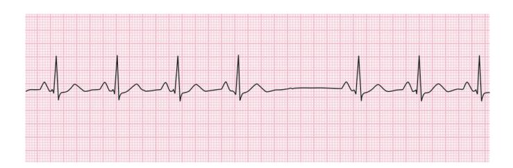 images/VVK-P-Osce 15. Cardiovascular System_page_0_Figure_4.jpeg