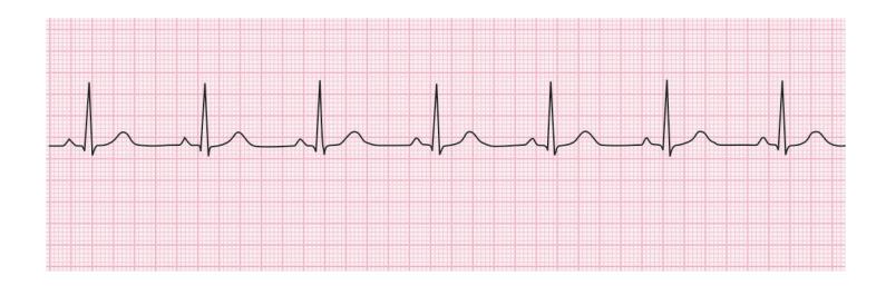 images/VVK-P-Osce 15. Cardiovascular System_page_0_Figure_6.jpeg