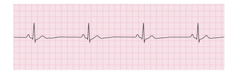 images/VVK-P-Osce 15. Cardiovascular System_page_0_Figure_8.jpeg