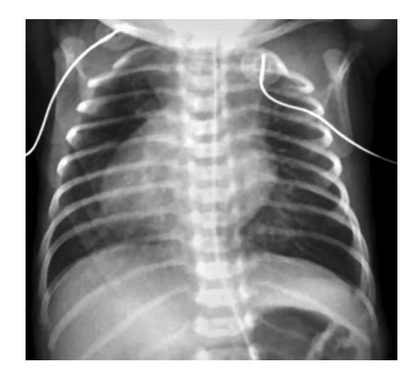 images/VVK-P-Osce 15. Cardiovascular System_page_10_Picture_10.jpeg