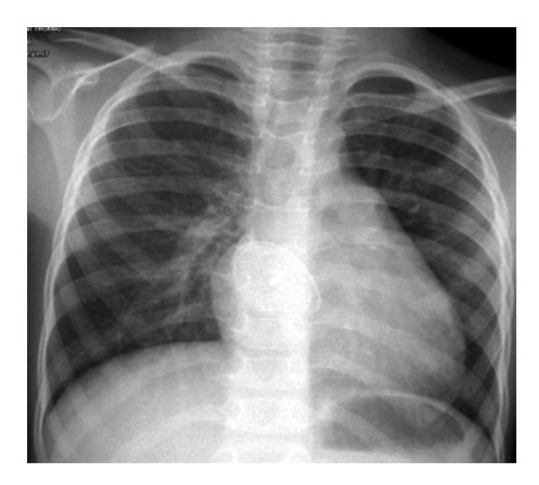 images/VVK-P-Osce 15. Cardiovascular System_page_11_Picture_3.jpeg
