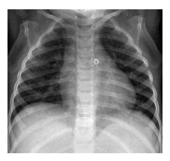 images/VVK-P-Osce 15. Cardiovascular System_page_11_Picture_8.jpeg