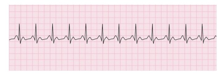 images/VVK-P-Osce 15. Cardiovascular System_page_1_Figure_3.jpeg