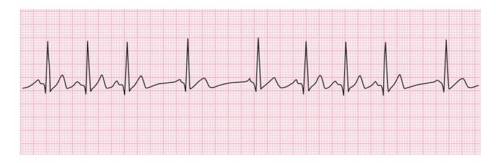 images/VVK-P-Osce 15. Cardiovascular System_page_1_Figure_5.jpeg