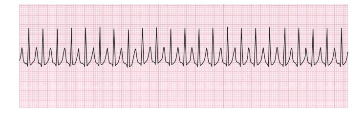 images/VVK-P-Osce 15. Cardiovascular System_page_1_Figure_7.jpeg