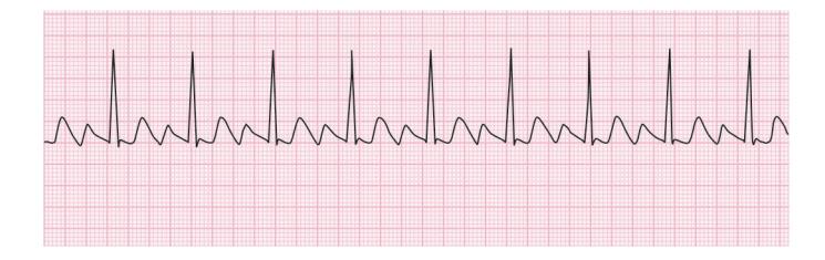 images/VVK-P-Osce 15. Cardiovascular System_page_1_Figure_9.jpeg
