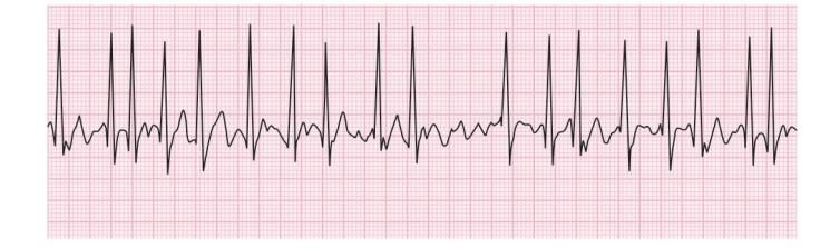 images/VVK-P-Osce 15. Cardiovascular System_page_2_Figure_11.jpeg