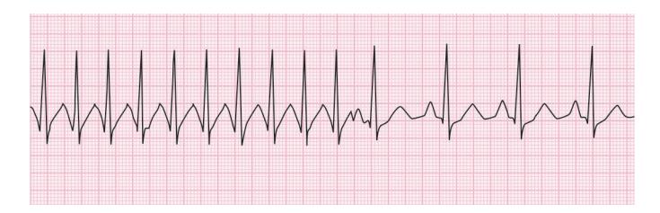 images/VVK-P-Osce 15. Cardiovascular System_page_2_Figure_3.jpeg