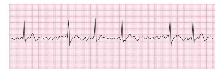 images/VVK-P-Osce 15. Cardiovascular System_page_2_Figure_5.jpeg