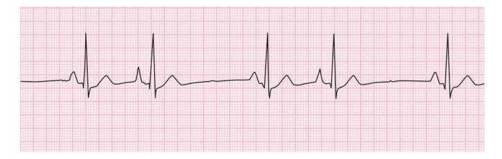 images/VVK-P-Osce 15. Cardiovascular System_page_2_Figure_7.jpeg