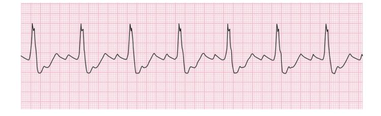 images/VVK-P-Osce 15. Cardiovascular System_page_2_Figure_9.jpeg