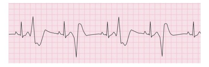 images/VVK-P-Osce 15. Cardiovascular System_page_3_Figure_11.jpeg