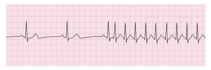 images/VVK-P-Osce 15. Cardiovascular System_page_3_Figure_3.jpeg